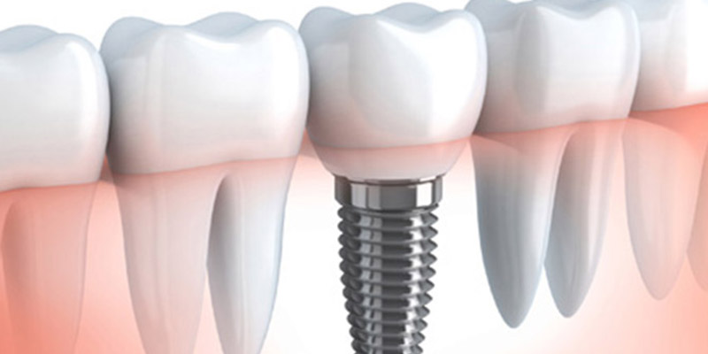 Teeth In An Hour/Day