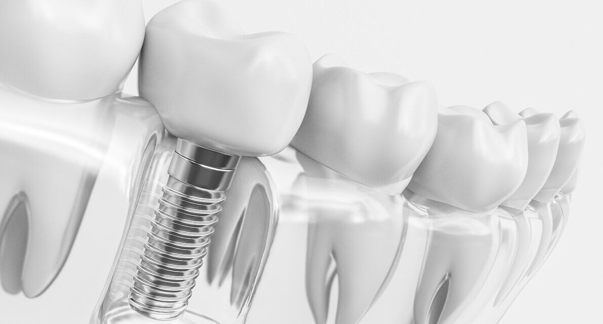 How much does it cost for an dental implant crown